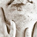 Retinol purging vs irritation example showing skin peeling and breakouts during early retinol use